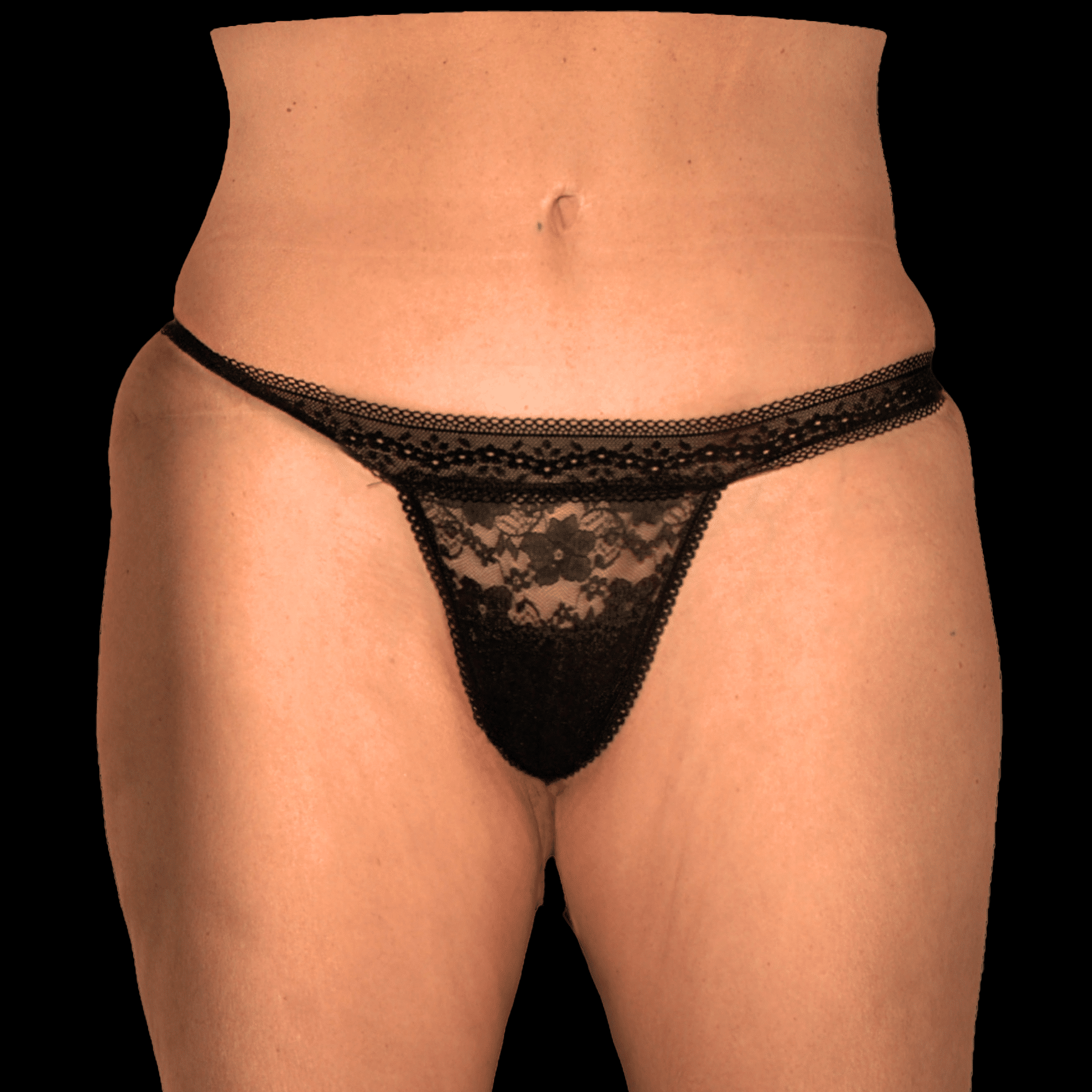 alloClae before and after - before