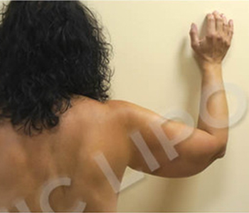 Procedure before and after - before
