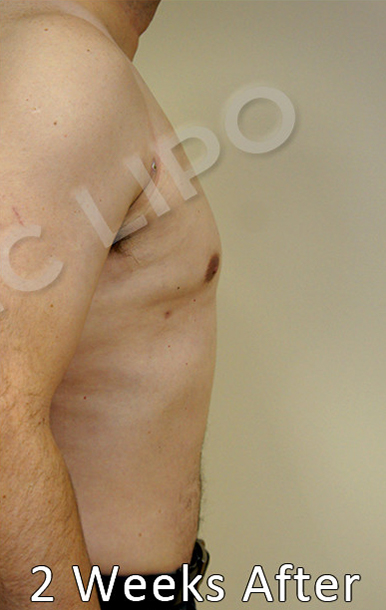 Procedure before and after - before