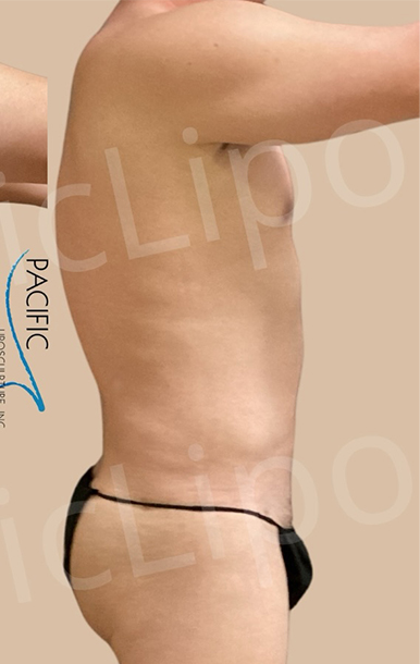 Procedure before and after - after