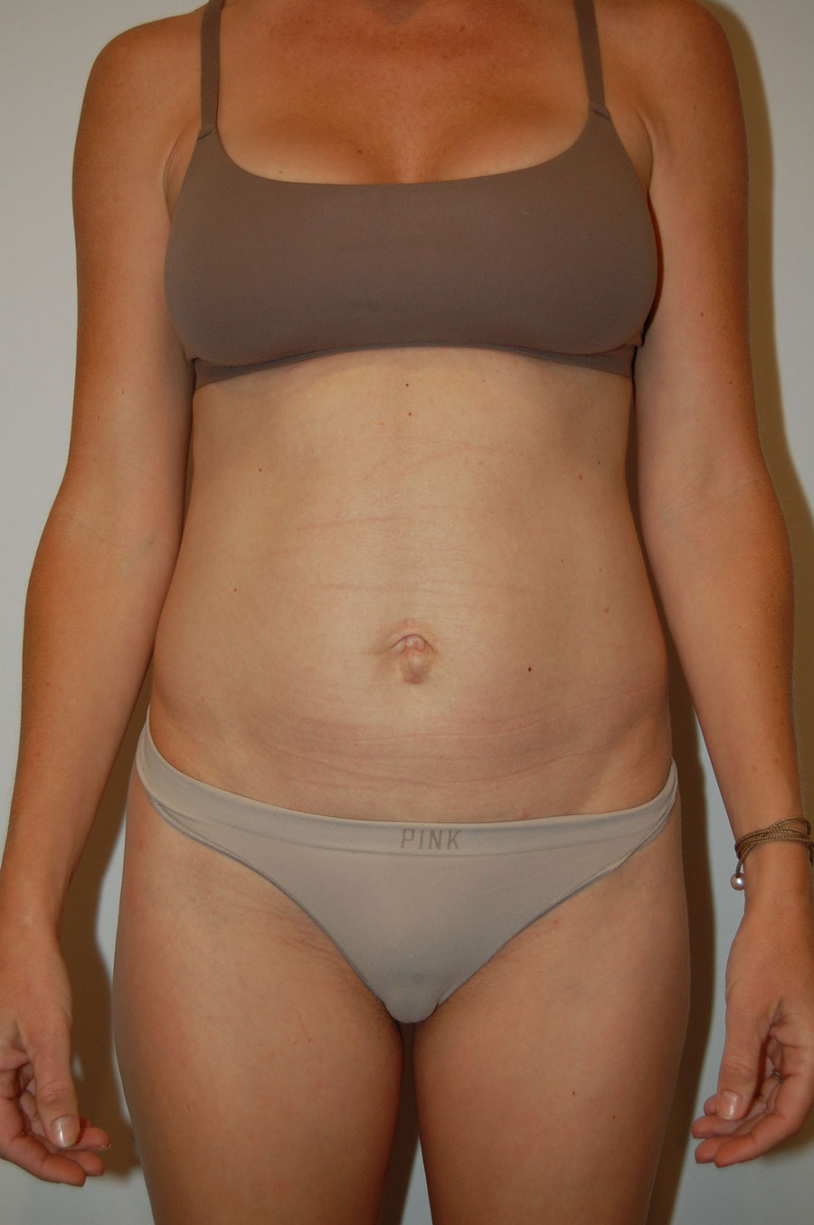 Procedure before and after - before