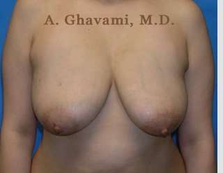 Procedure before and after - before