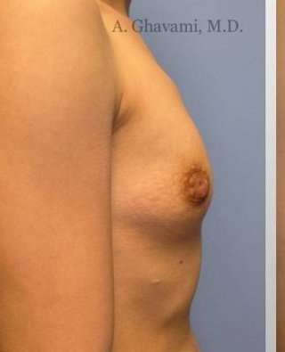 Procedure before and after - before