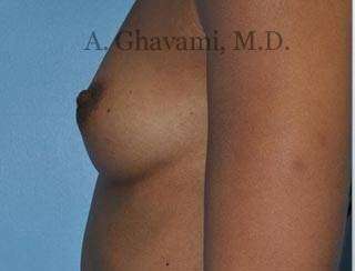 Procedure before and after - before