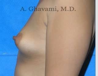 Procedure before and after - before