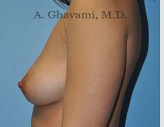 Procedure before and after - before