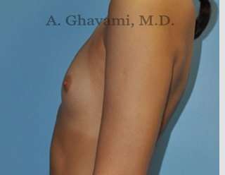 Procedure before and after - before