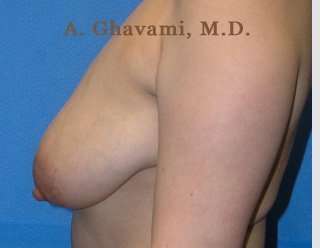 Procedure before and after - before
