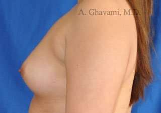 Procedure before and after - before