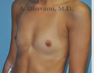 Procedure before and after - before