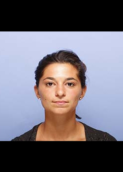Rhinoplasty before and after - after