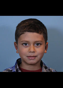 Procedure before and after - after