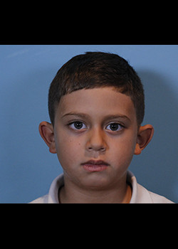 Procedure before and after - before