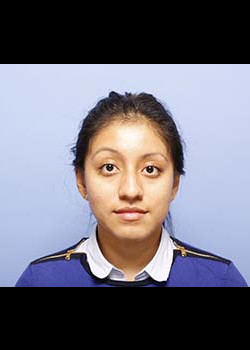 Rhinoplasty before and after - before