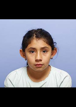 Procedure before and after - before