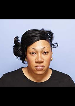 Rhinoplasty after — Dr. Thomas Romo