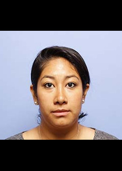 Rhinoplasty after — Dr. Thomas Romo