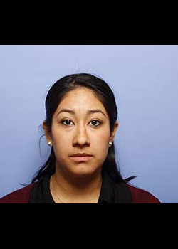 Rhinoplasty before — Dr. Thomas Romo