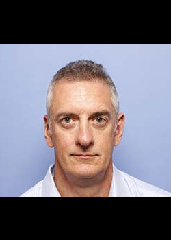 Blepharoplasty before and after - after
