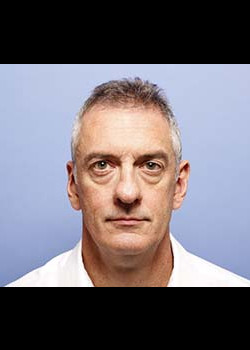 Blepharoplasty before and after - before