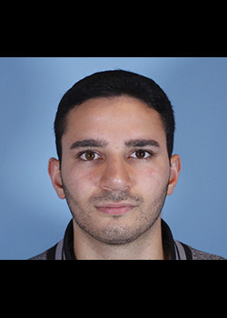 Rhinoplasty after — Dr. Thomas Romo