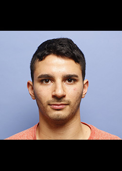 Rhinoplasty before — Dr. Thomas Romo