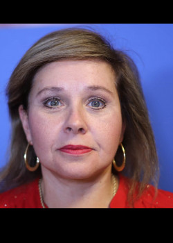 Facelift after — Dr. Thomas Romo