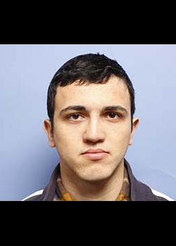 Rhinoplasty after — Dr. Thomas Romo
