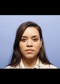 Rhinoplasty before — Dr. Thomas Romo
