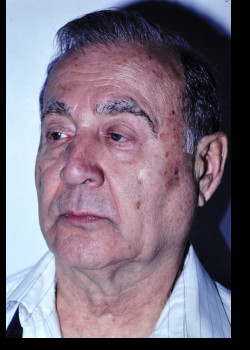 Facelift before — Dr. Thomas Romo