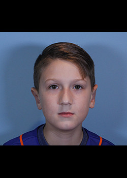 Procedure before and after - after