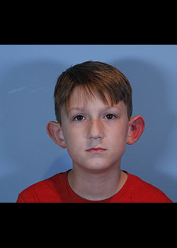 Procedure before and after - before