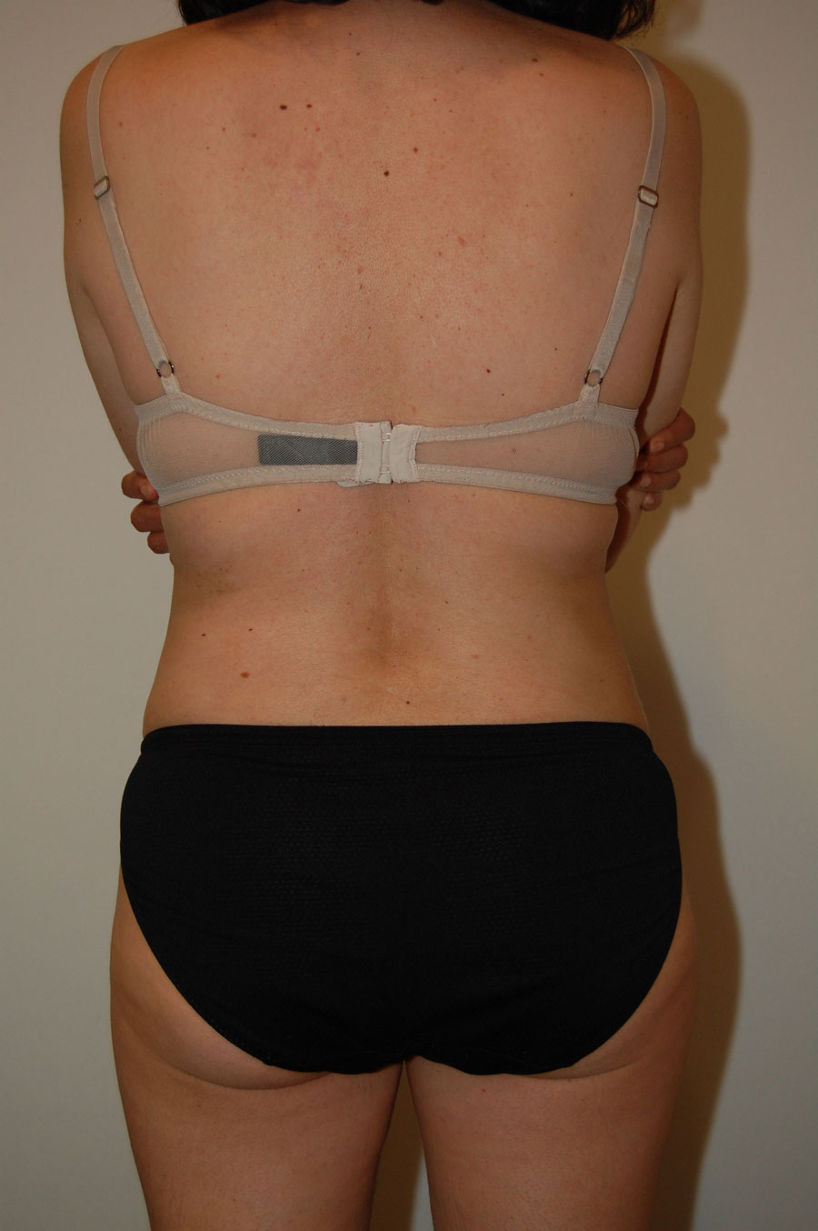 Procedure before and after - after