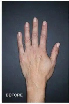 Procedure before and after - before