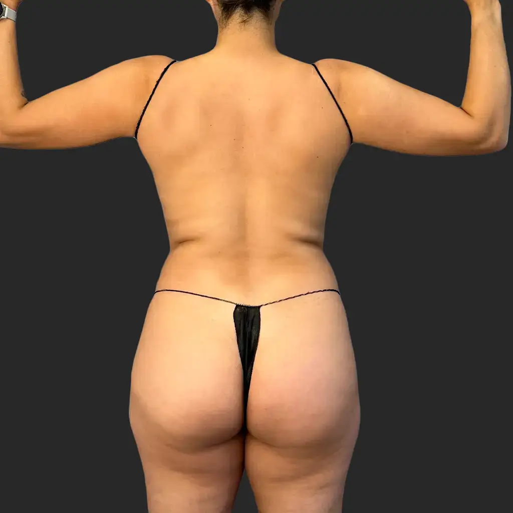 Procedure before and after - before