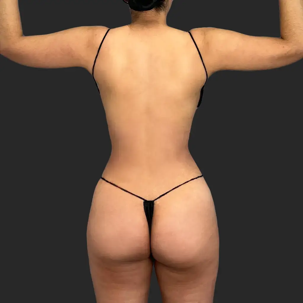 Procedure before and after - after