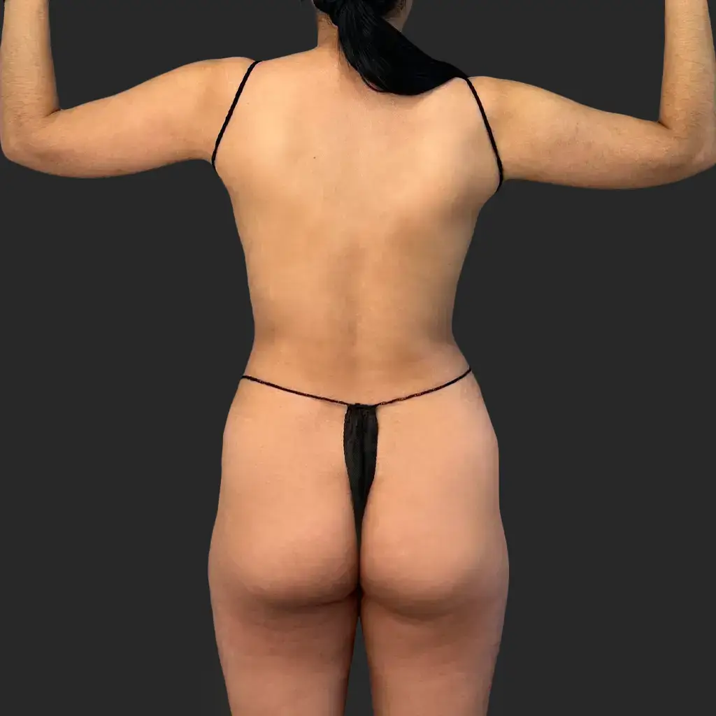 Procedure before and after - before