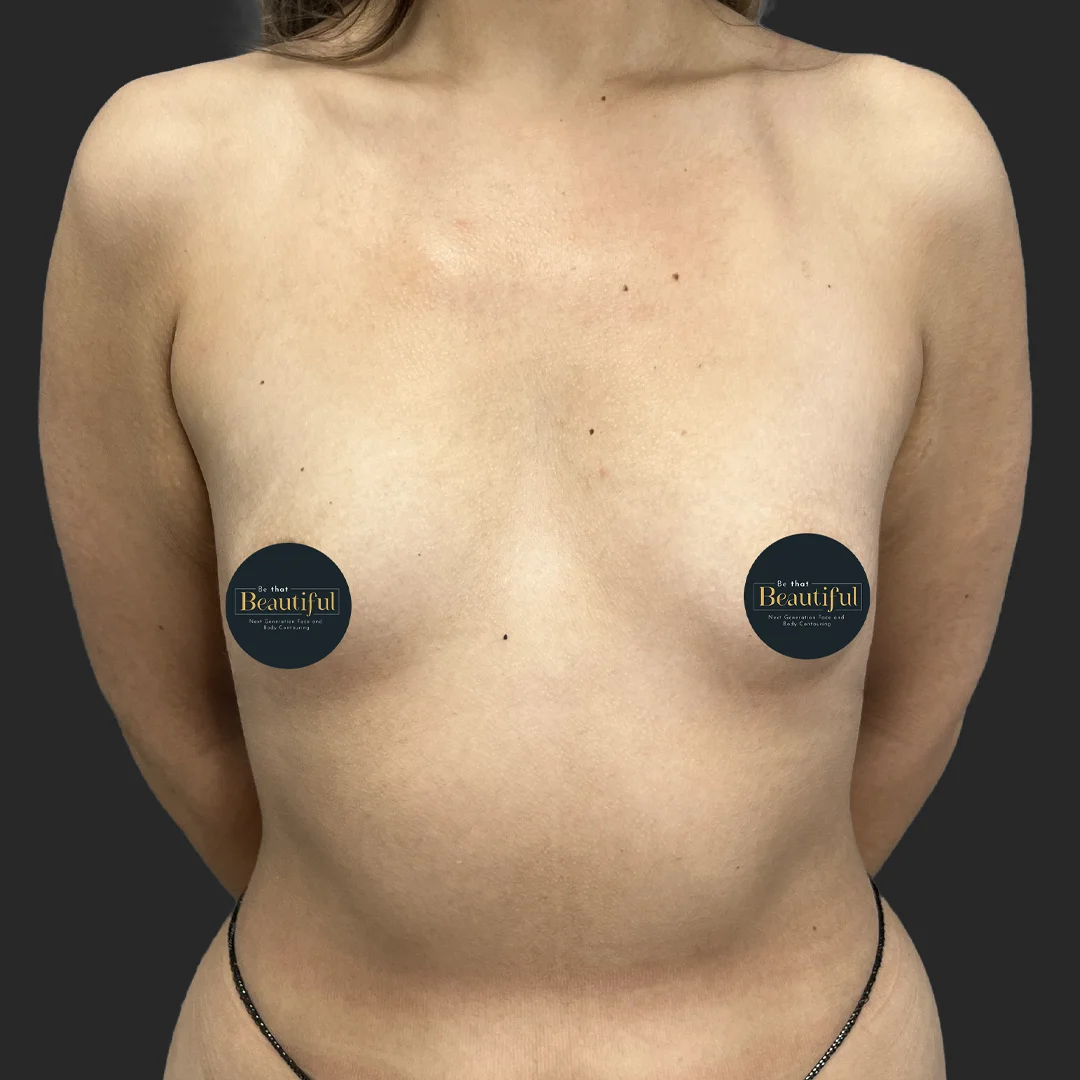 Procedure before and after - before