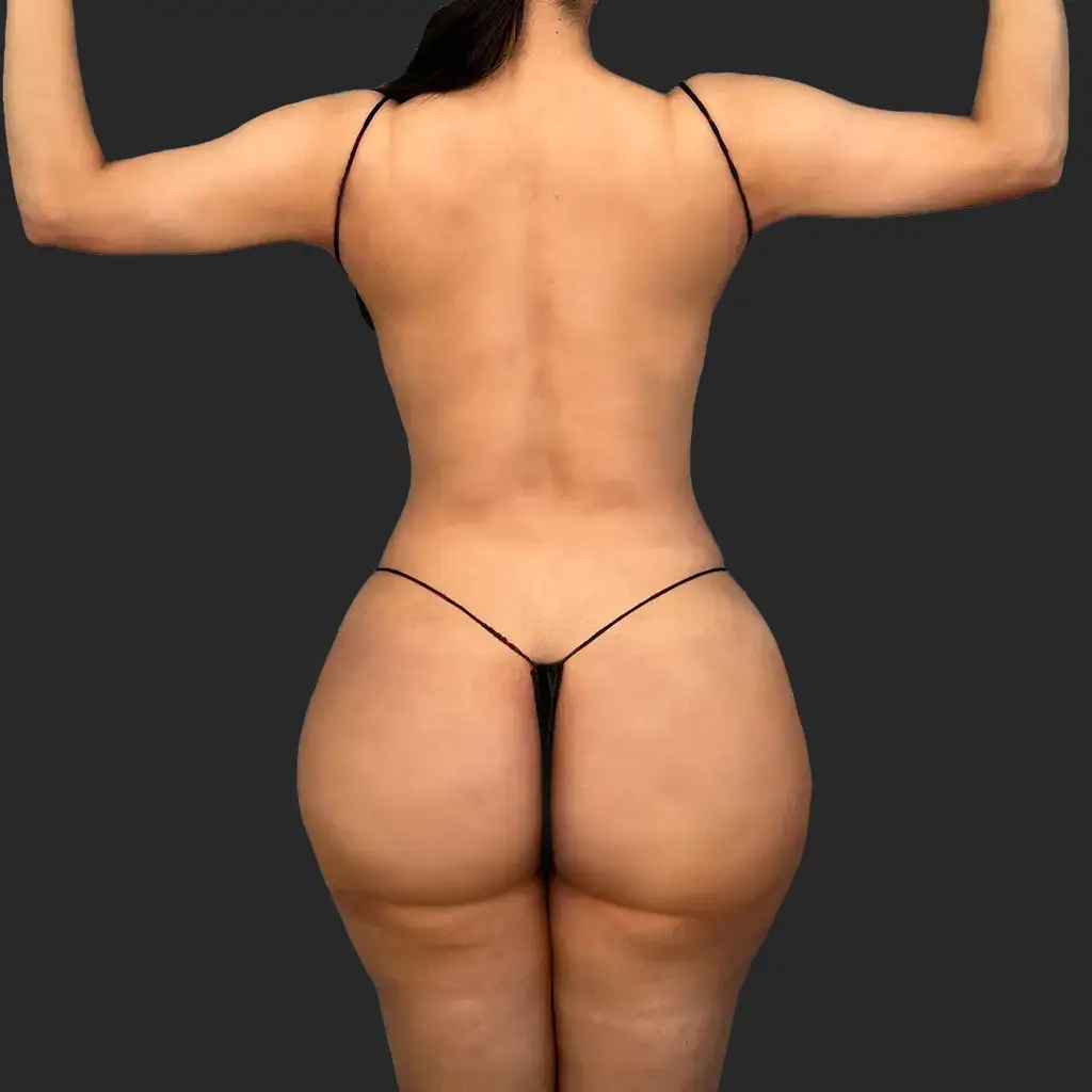 Procedure before and after - before