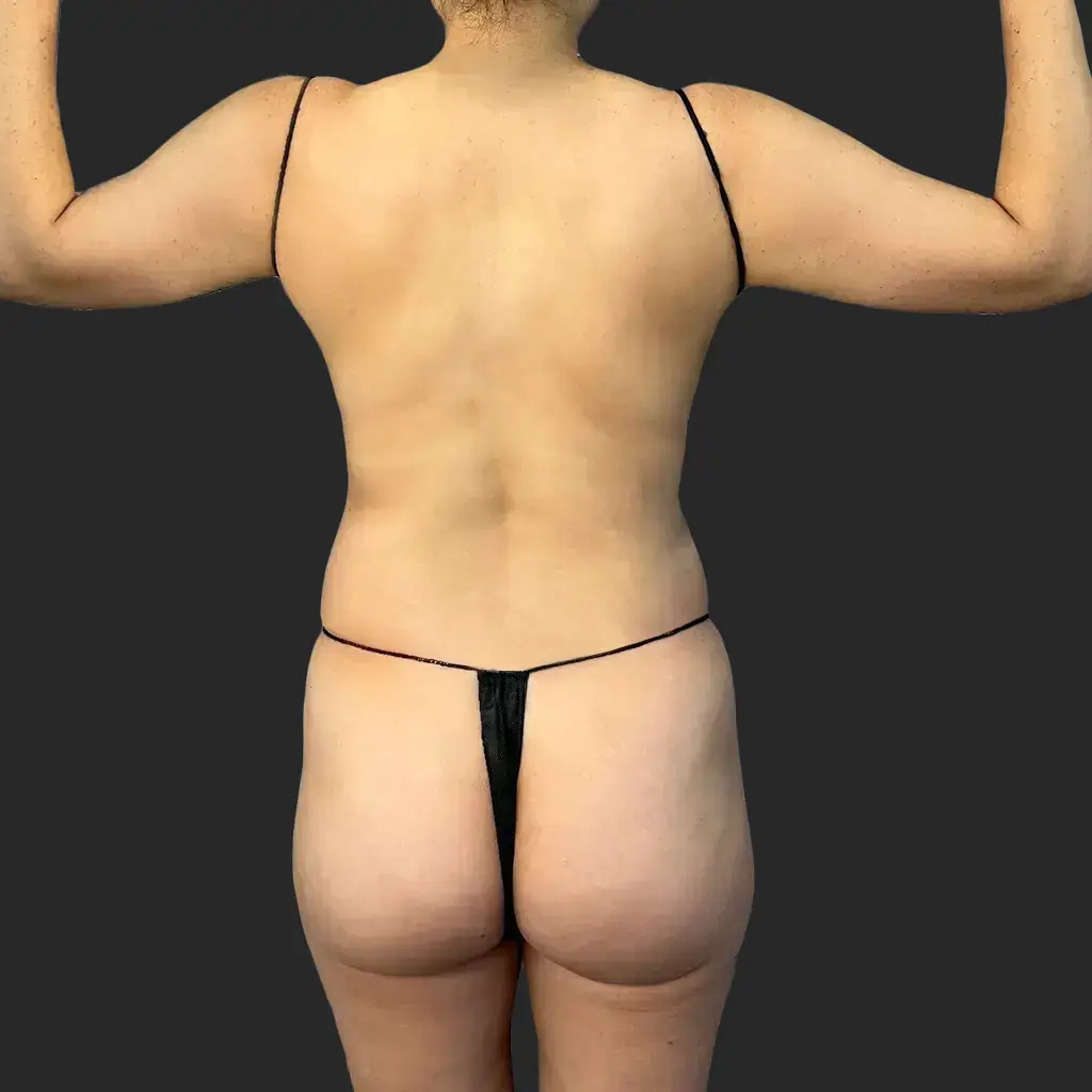 Procedure before and after - before