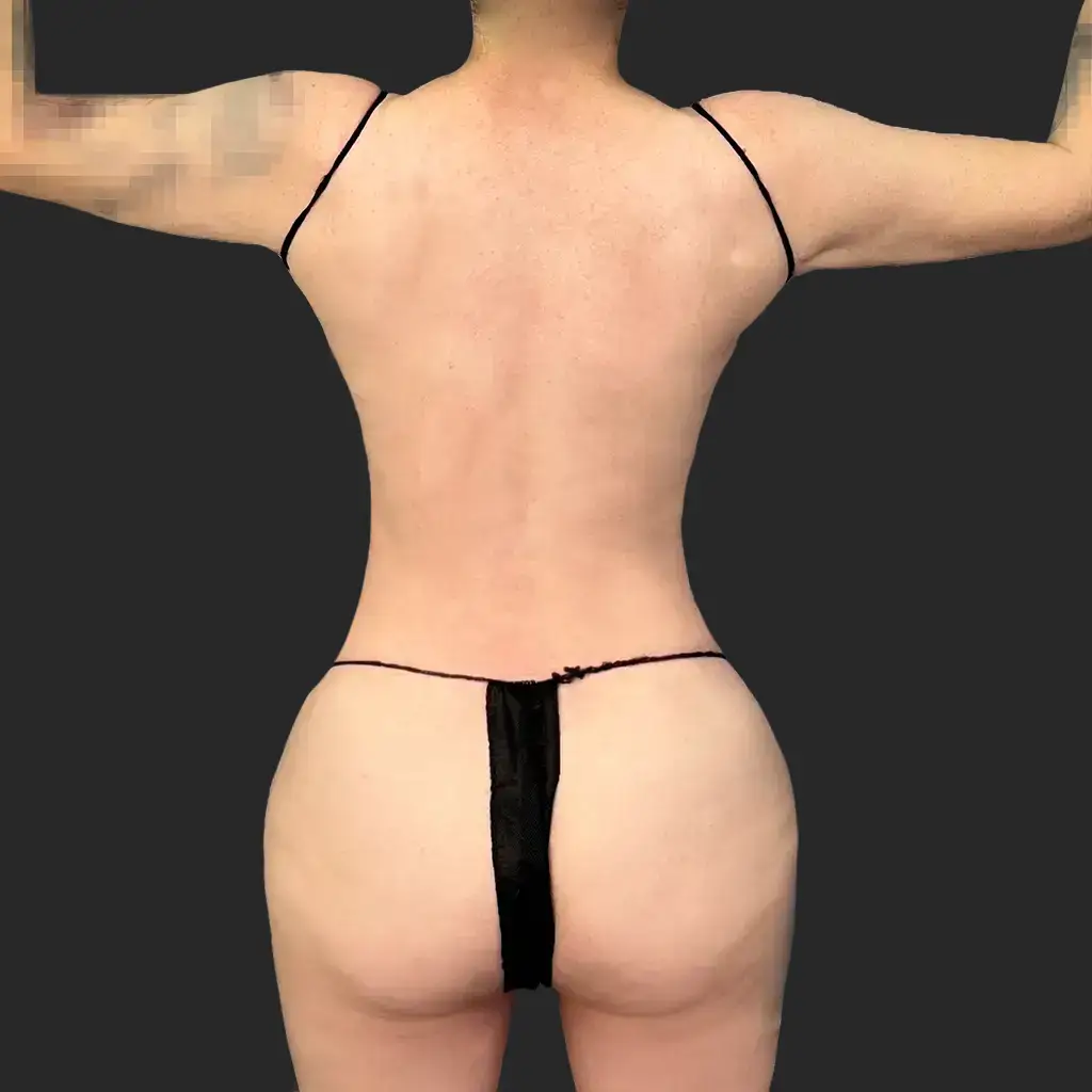 Procedure before and after - after