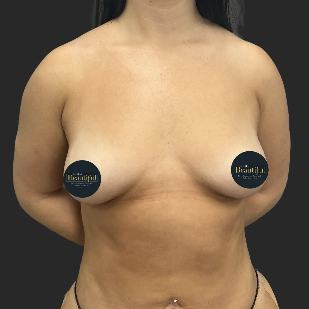 Procedure before and after - before