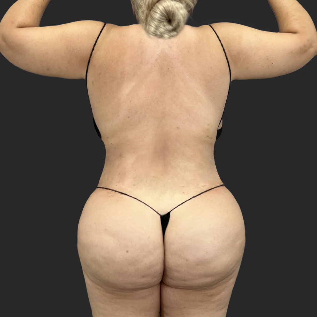 Procedure before and after - after