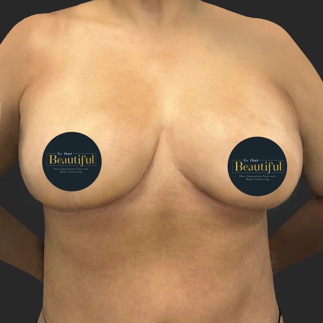 Procedure before and after - after