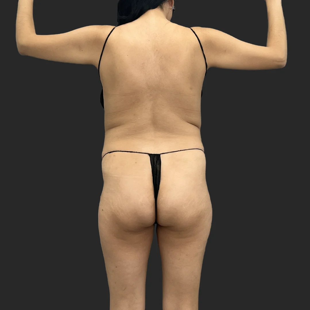 Procedure before and after - before