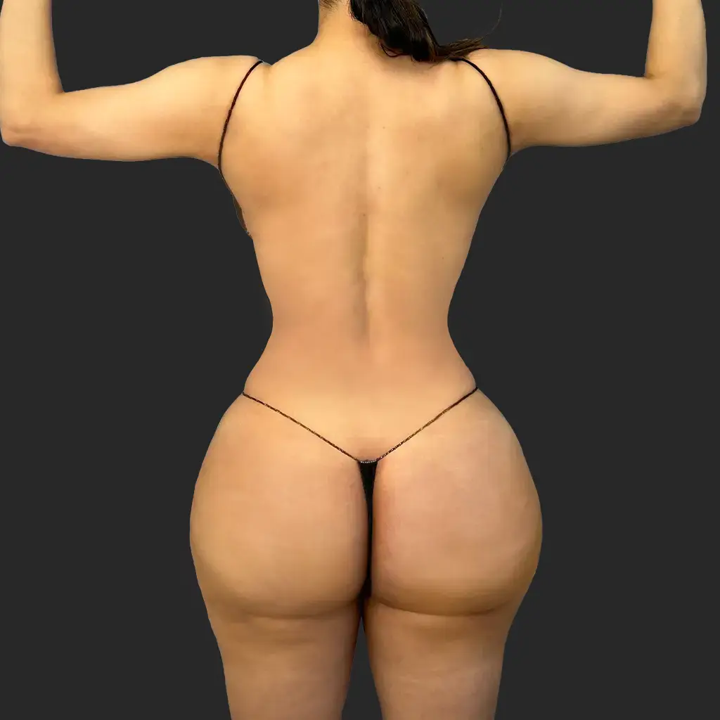 Procedure before and after - after