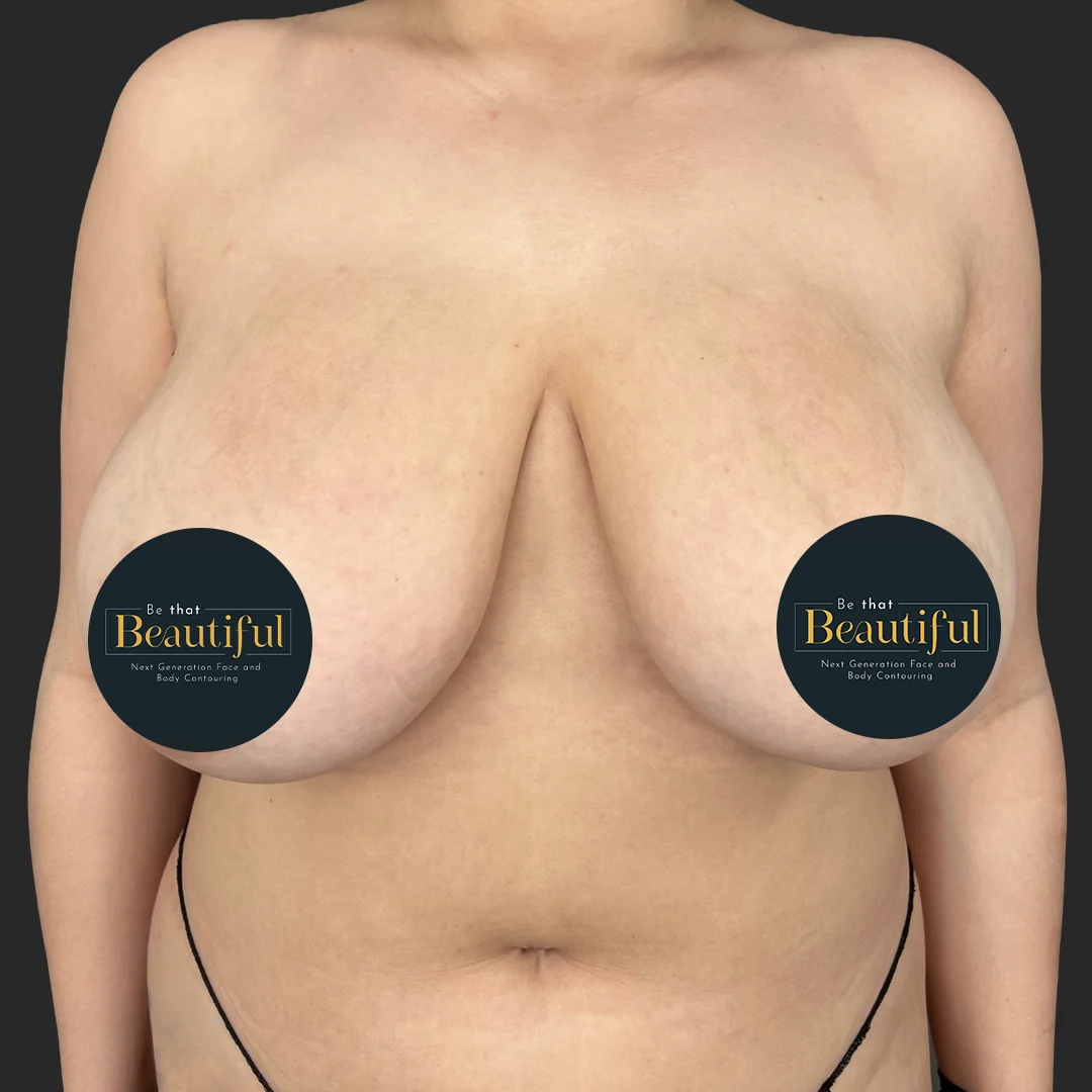 Procedure before and after - before
