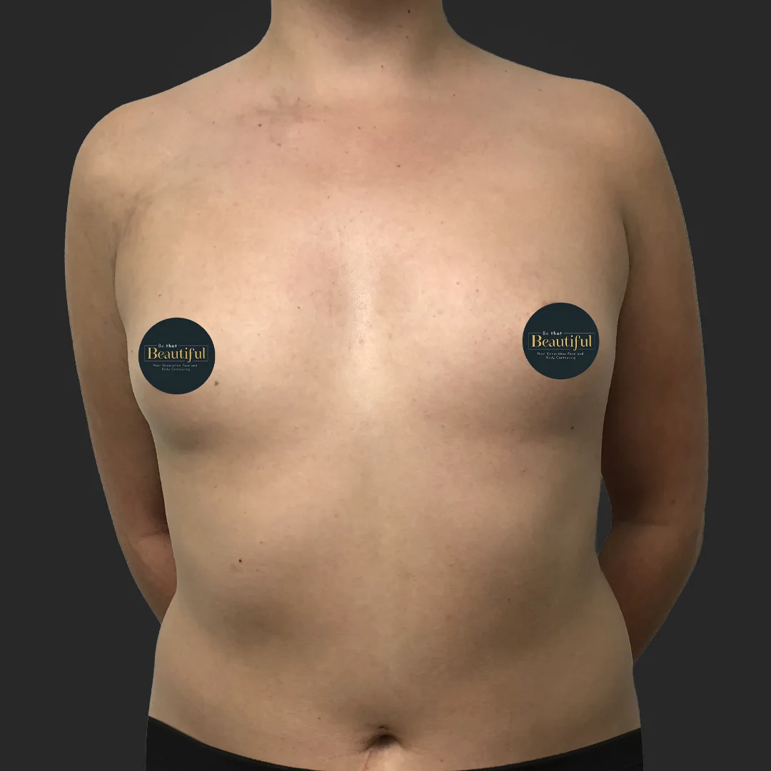 Procedure before and after - before