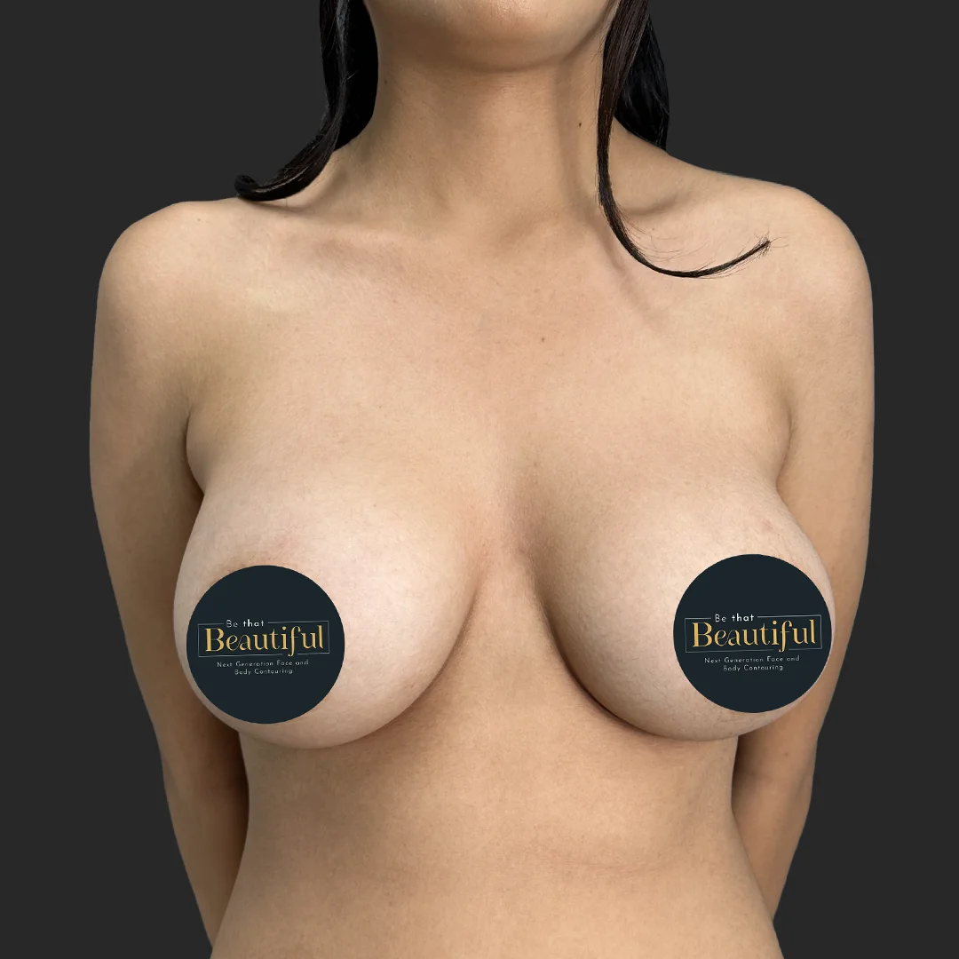 Procedure before and after - after