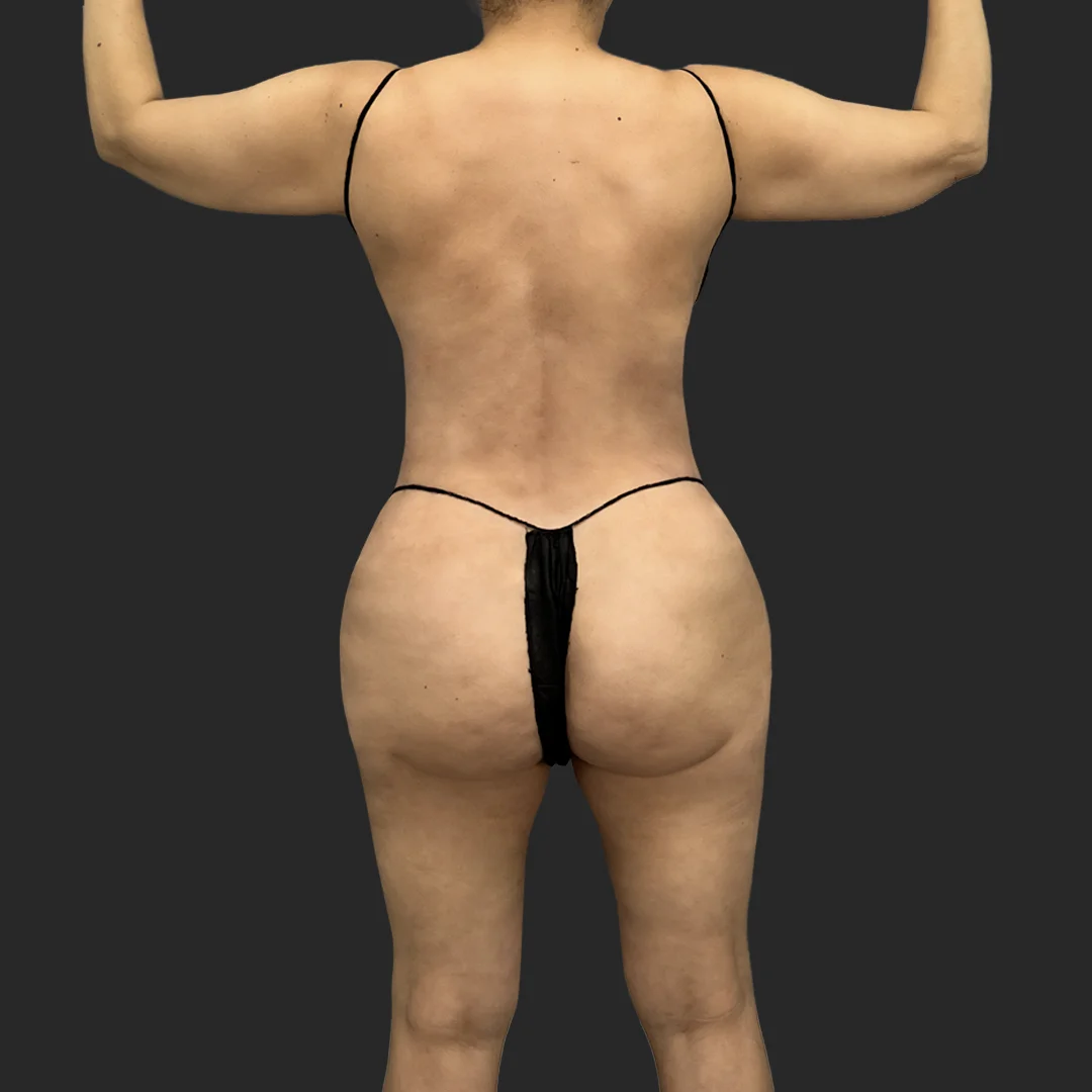 Procedure before and after - after